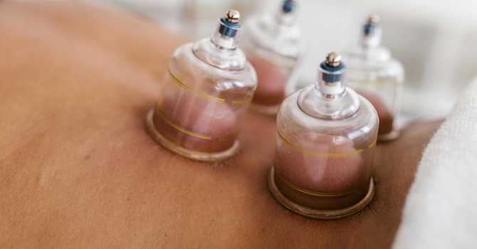 Cupping